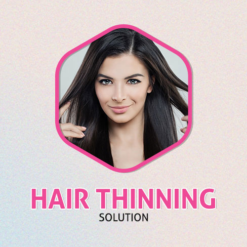 Hair-Thinning-Solution